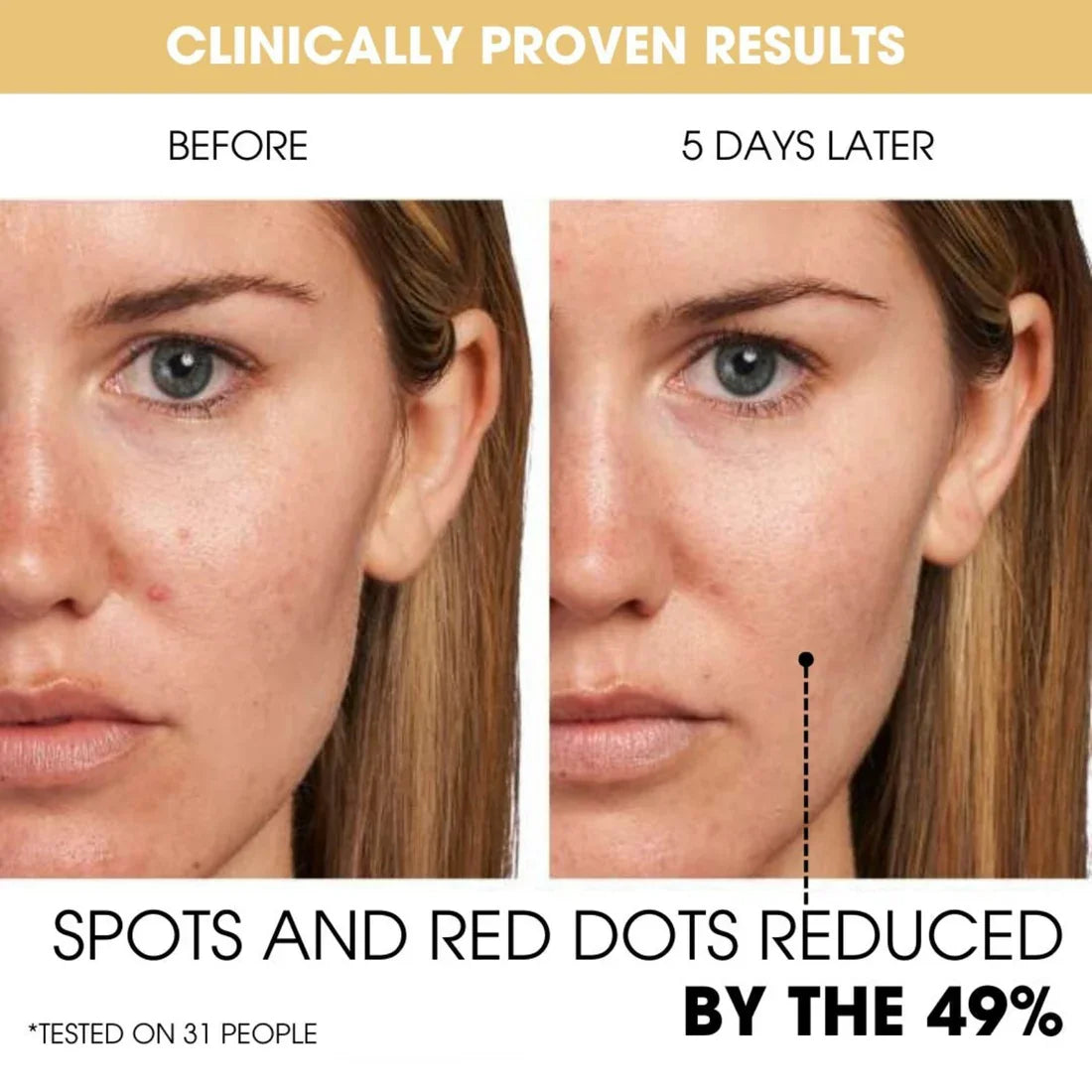 Viditelné záření a hydratovaná pleť díky kapslím C